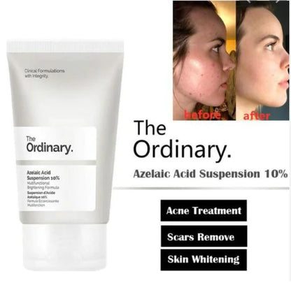 The Ordinary Azelaic Acid Suspension 10% Cream 30ml